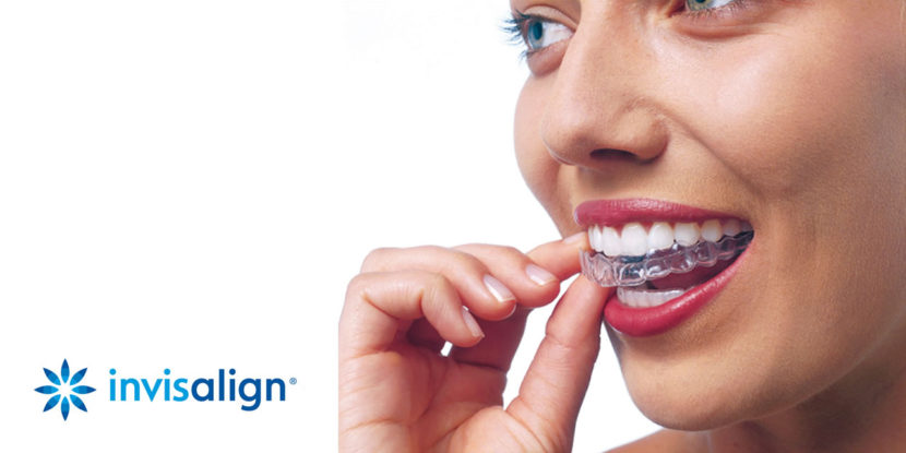 invisalign-aligners