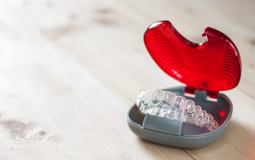 invisalign or braces