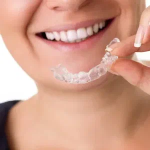 Clear Retainers