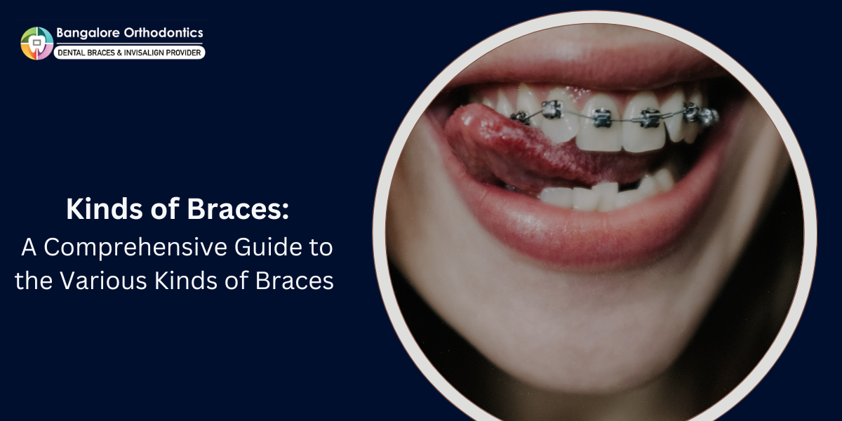 Kinds of Braces