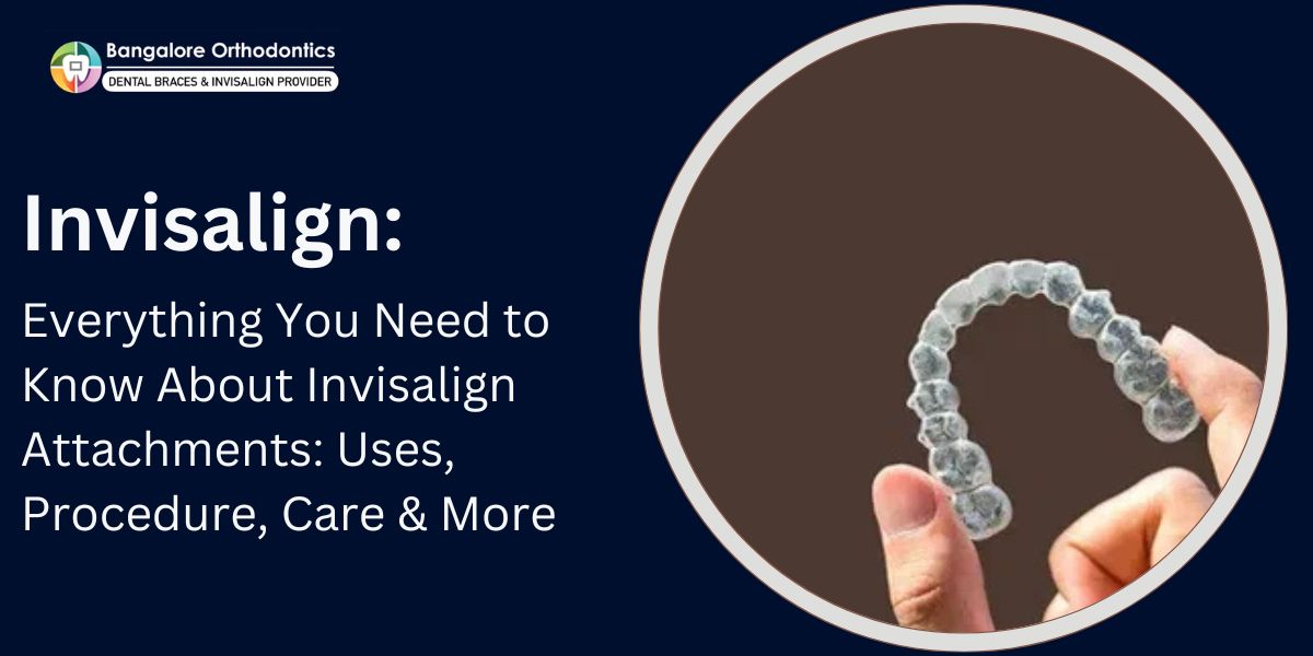 Invisalign