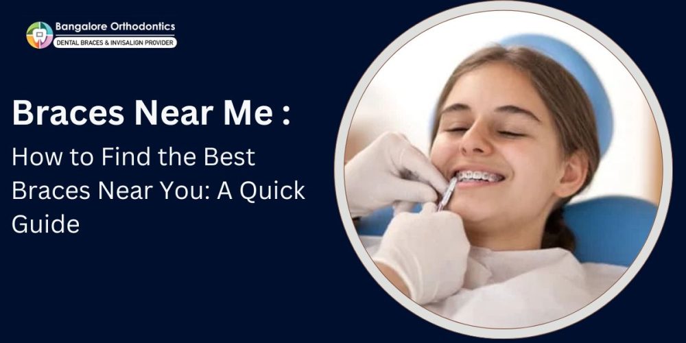 Braces Near Me