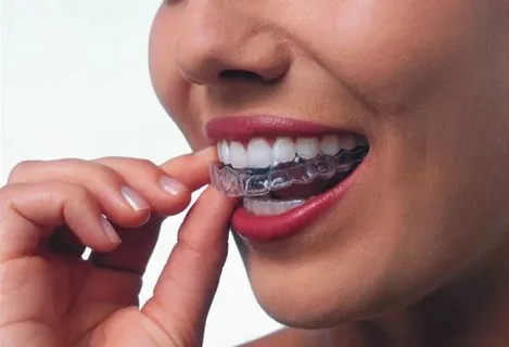 Invisalign Doctor Website