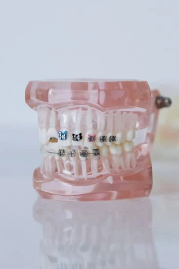 Braces Near