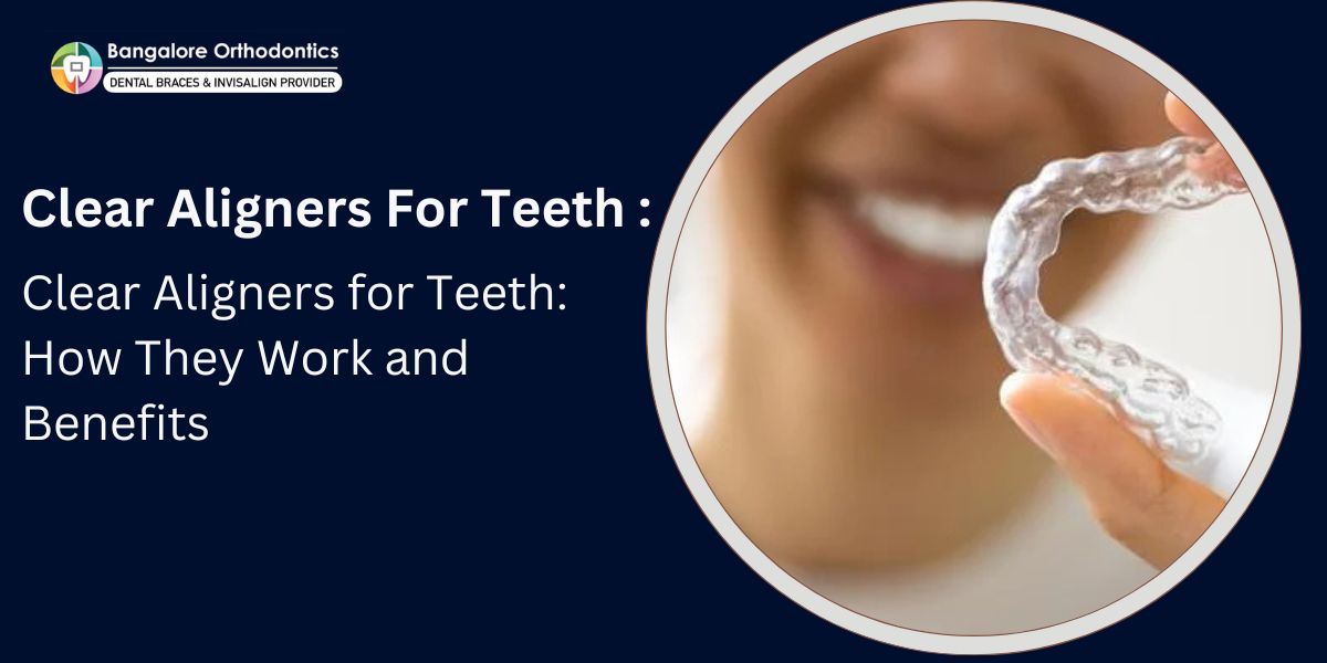 Clear Aligners for Teeth