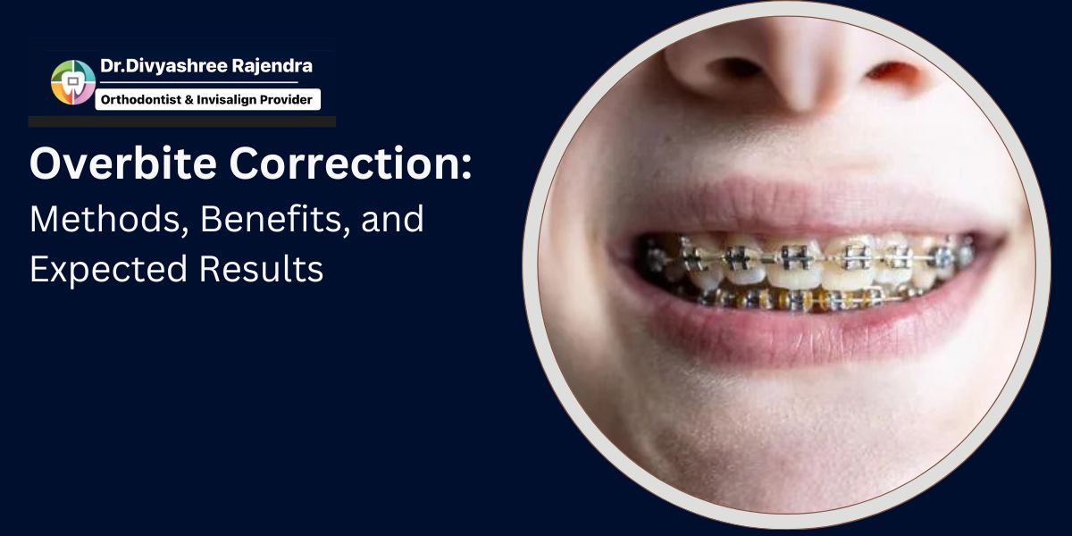 Overbite Correction