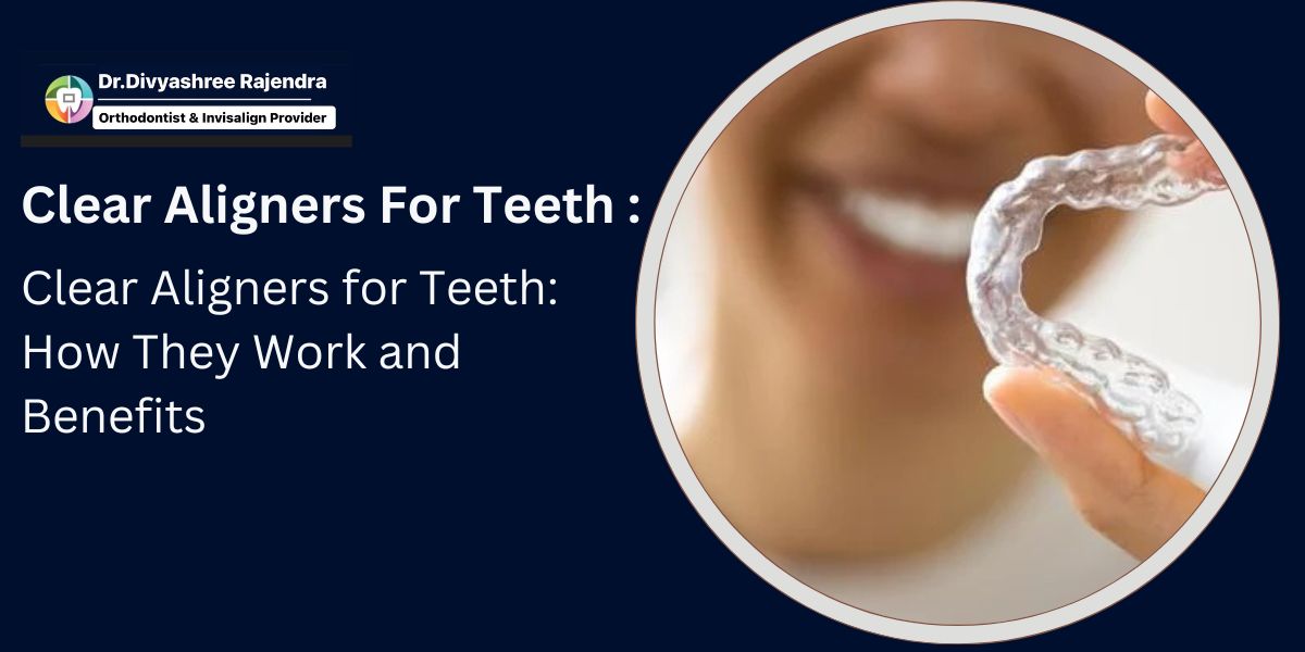 Clear Aligners for Teeth
