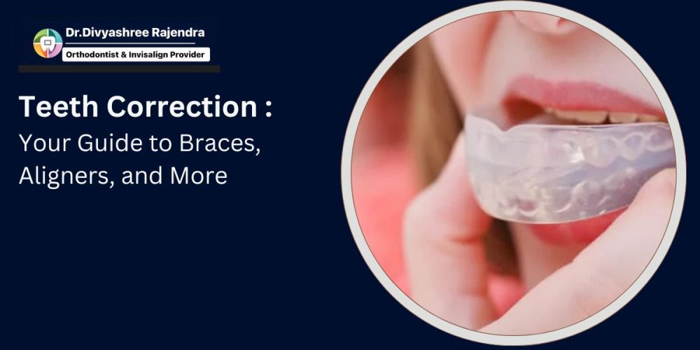 Teeth Correction