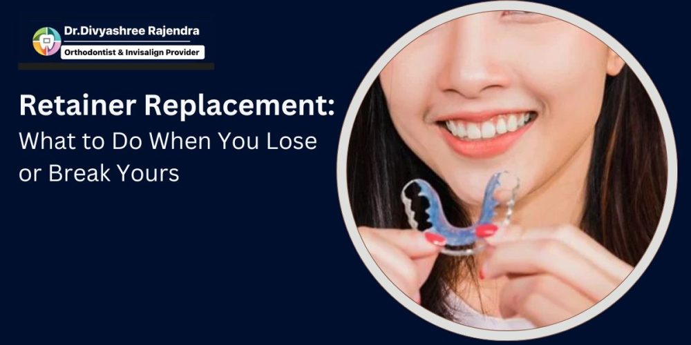 Retainer Replacement