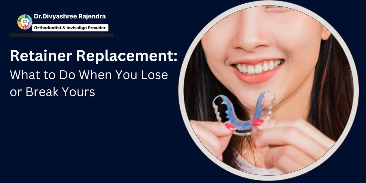 Retainer Replacement