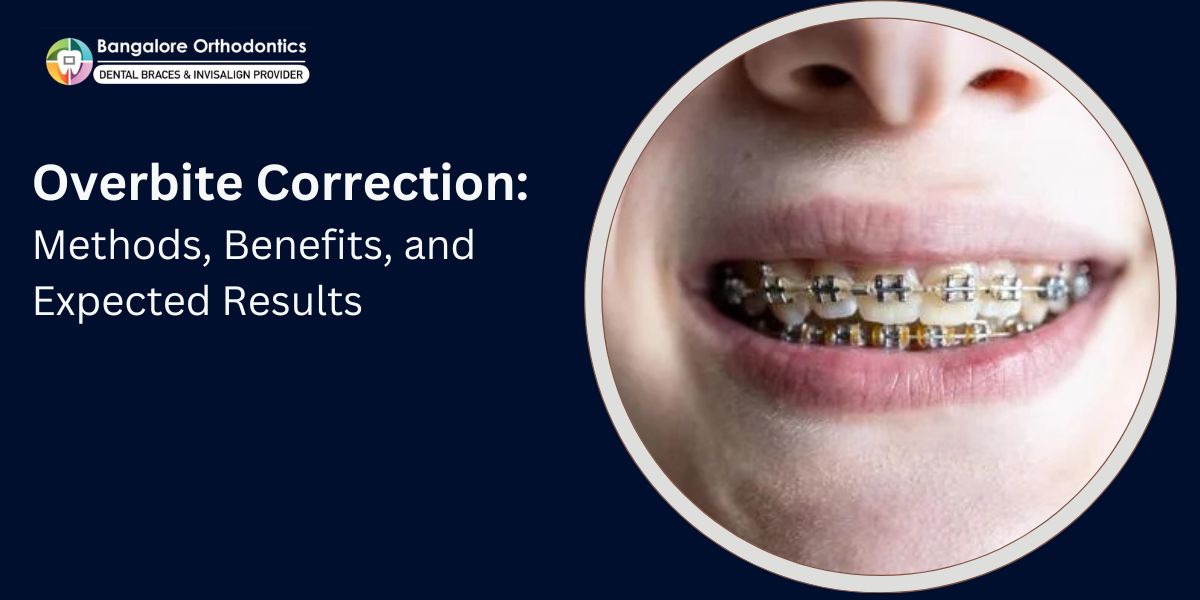 Overbite Correction