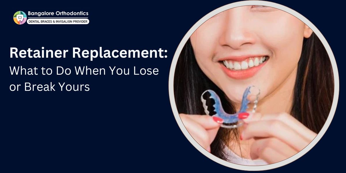 Retainer Replacement