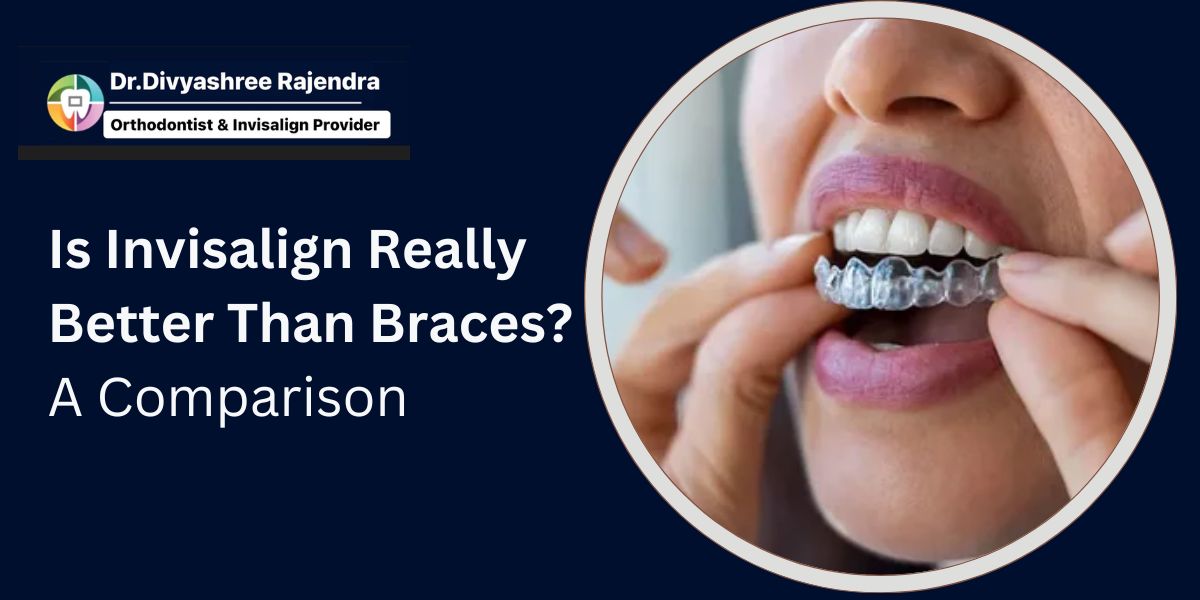 is invisalign better than braces