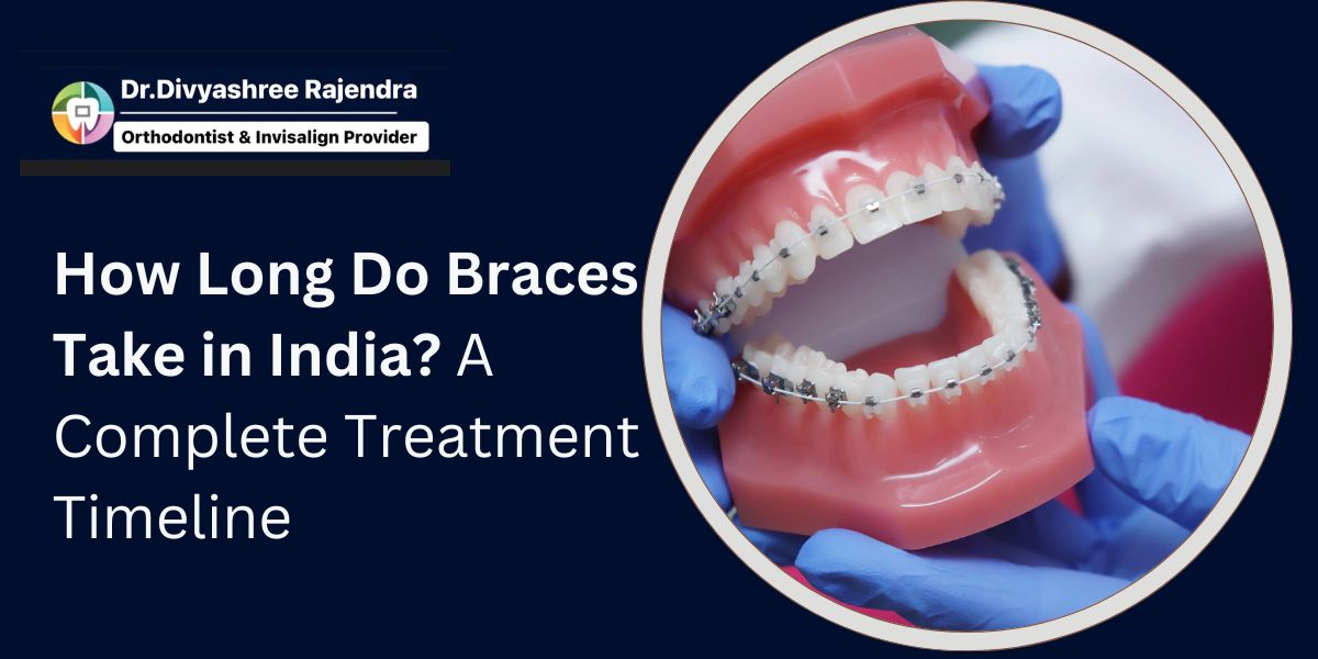how long do braces take in india