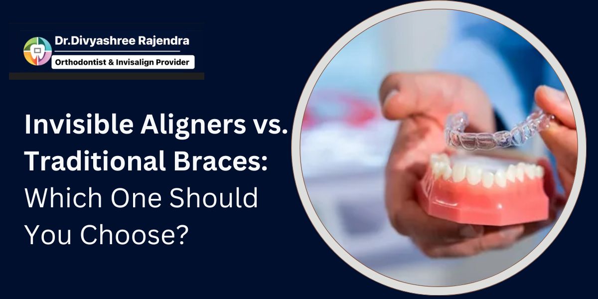 invisible dental braces