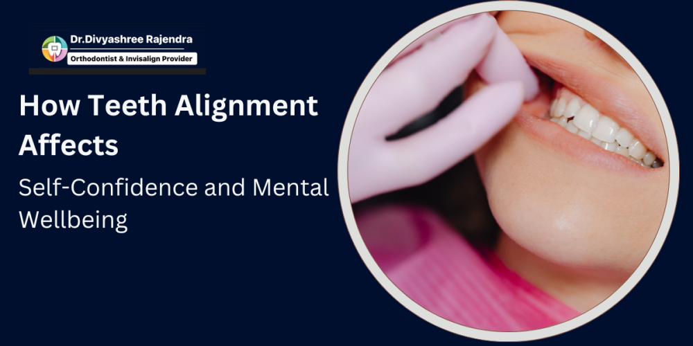 teeth alignment benefits
