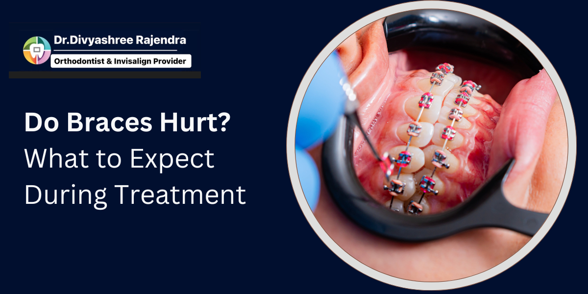 braces pain management