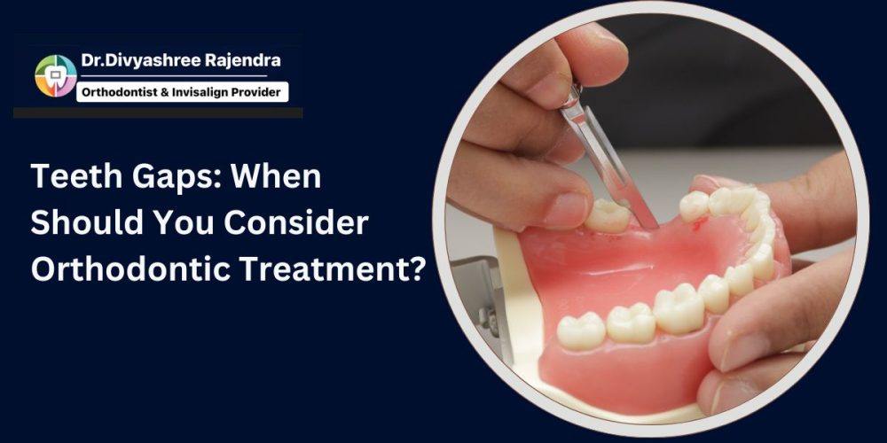 teeth gaps when you should consider orthodontis treatement